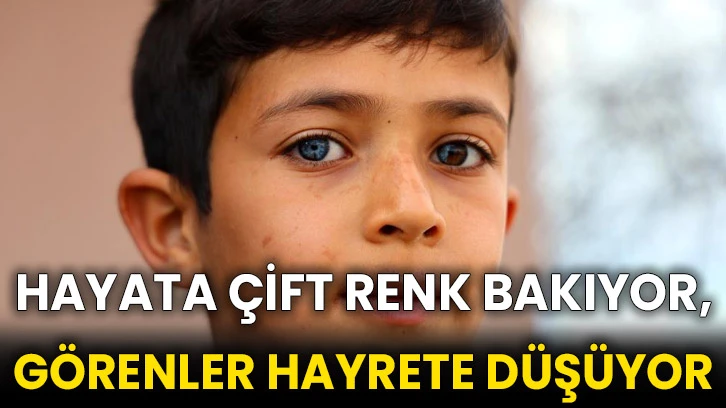 Hayata çift renk bakıyor, görenler hayrete düşüyor