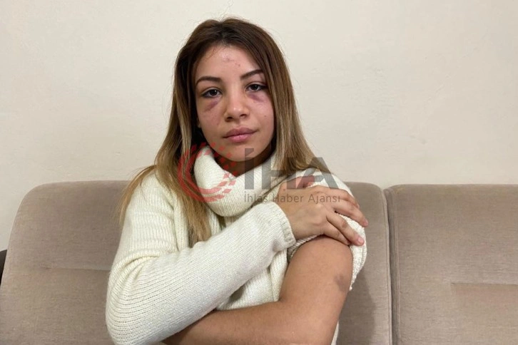 Üsküdar’da koca dehşeti: 4 aylık hamile karısını çocuğunun gözü önünde dövdü