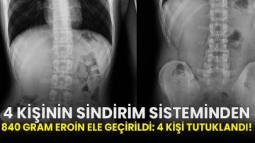 4 kişinin sindirim sisteminden 840 gram eroin ele geçirildi: 4 kişi tutuklandı!