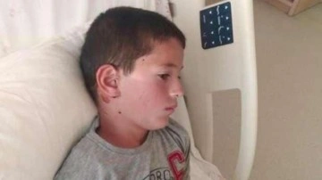 Ankara'da 8 yaşındaki çocuğa köpek saldırdı