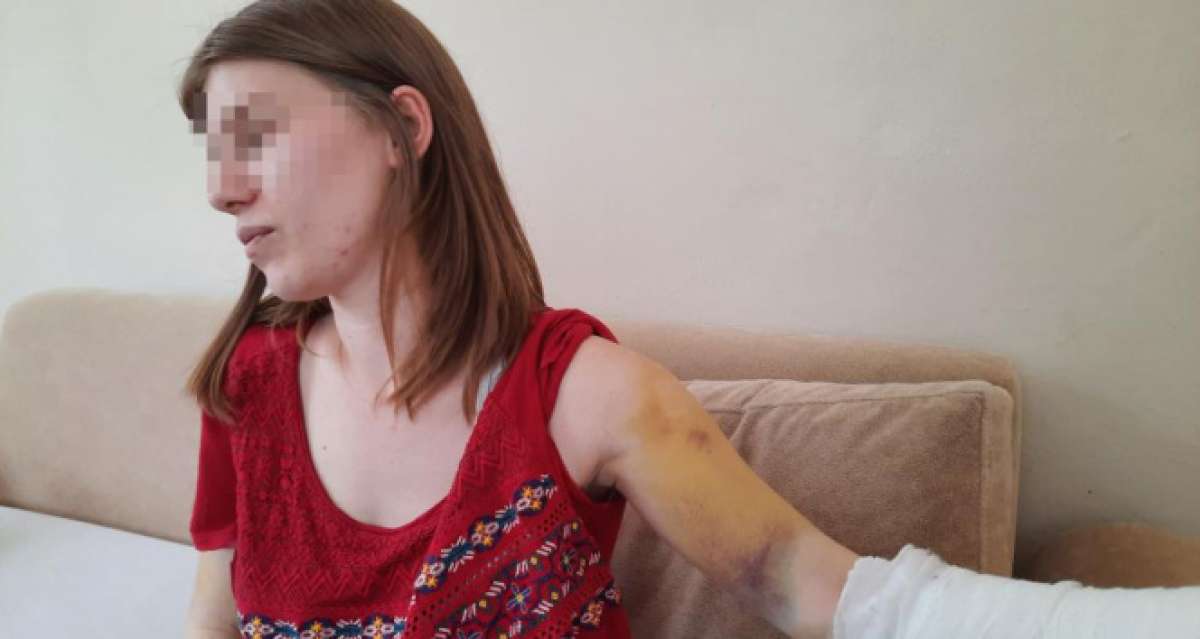 Beyzbol sopasıyla öldüresiye dövülen genç kadın: 'Öleceğimi sandım'