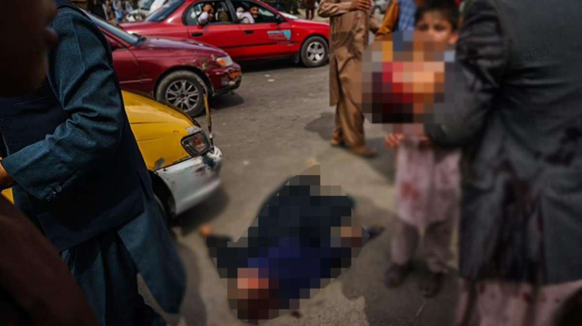 Bu görüntülere yürek dayanmaz! Taliban zulmü çocukları da kanlar içinde bıraktı