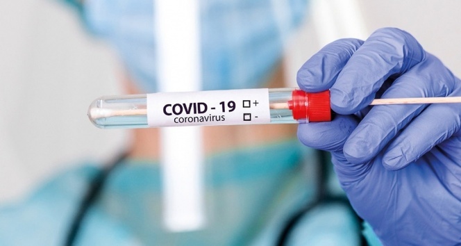Covid-19 aşısının Ukrayna'ya geleceği tarih belli oldu