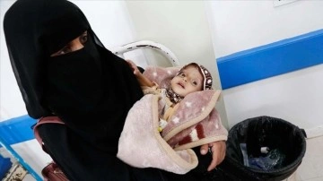 DSÖ: Yemenli çocukların yüzde 75'i yetersiz beslenmeden muzdarip