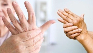 Dünyada 350 milyon kişide görülen artrit hastalığına dikkat!