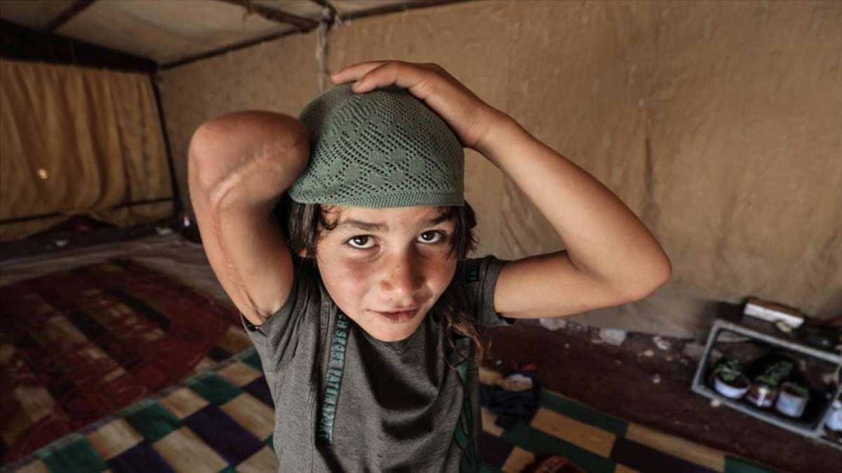 Esed rejiminin saldırılarında kolunu kaybeden küçük Rakan'ın tek hayali protez kol