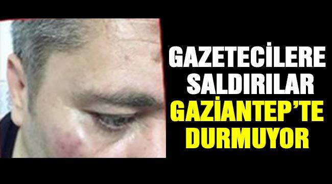 Gazetecilere Saldırılar Gaziantep’te Durmuyor