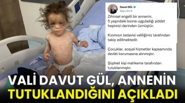 Gaziantep'te 5 yaşındaki kızına işkence eden zihinsel engelli anne tutuklandı