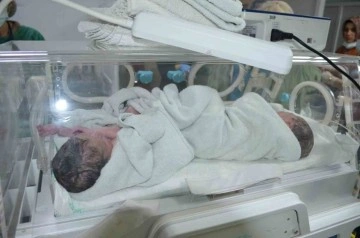 Gaziantep’te üçüz bebek sevinci
