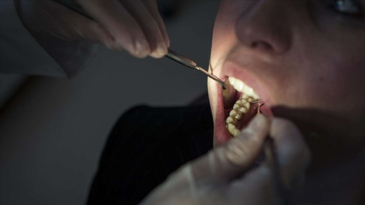 İngiltere'de ülke genelinde diş tedavisi sıkıntısı yaşanıyor