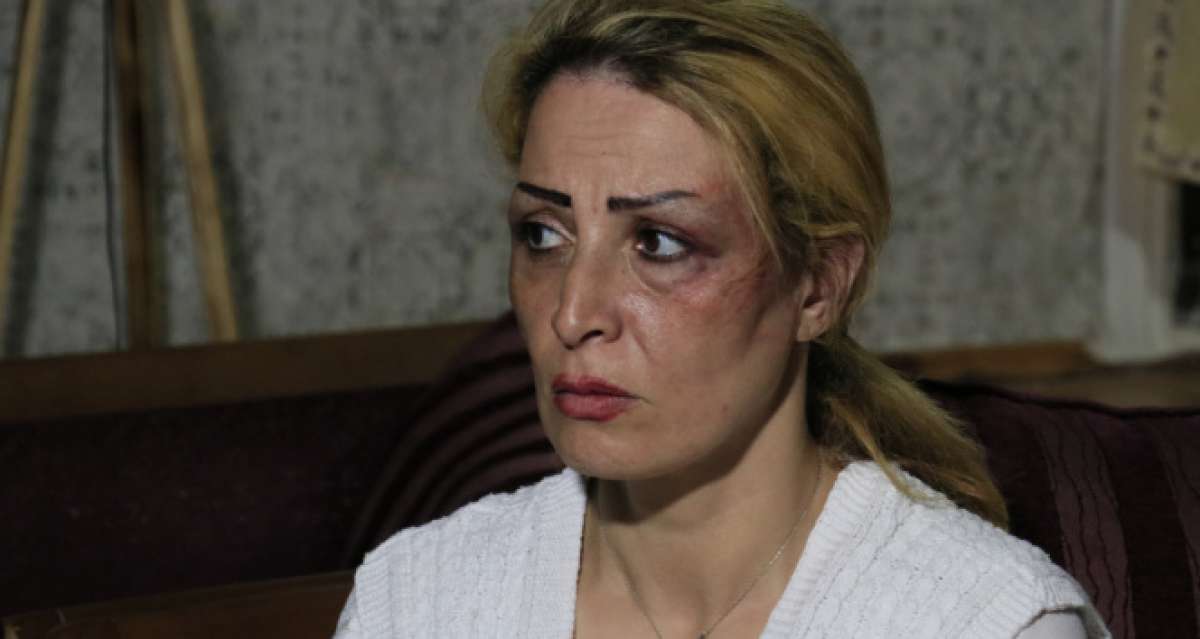 İran uyruklu karısını darp eden şahıs tutuklandı