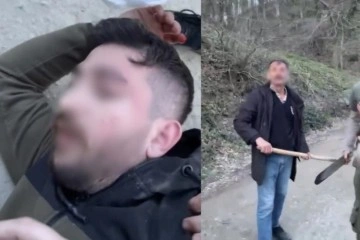 İstanbul’da baltalı oduncu dehşeti kamerada: Başına odunla vurulan genç felç kaldı