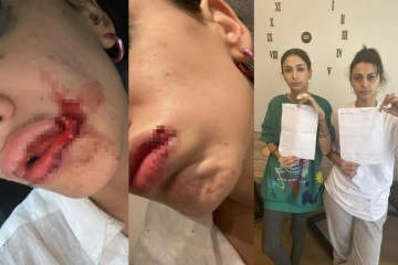 İstanbul’da kız kardeşler sokak ortasında dehşeti yaşadı: Önce darp sonra gasp edildiler