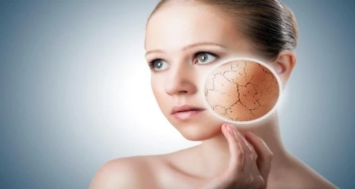 Kış Aylarında Cilt Kuruluğuna Dikkat