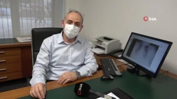 Prof. Dr. Yılmaz Bülbül: 'Covid'i ağır geçirenlerde kalıcı akciğer hasarı riski daha yükse