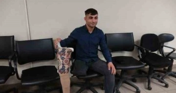Protez bacağı enkazda kalmıştı, Bolu’da yenisi takıldı