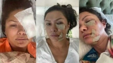 Şarkıcı Tuğba Altıntop köpek saldırısına uğradı, yüzüne dikiş atıldı