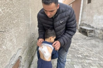 Sokak k&ouml;peklerinin saldırdığı 4 yaşındaki &ccedil;ocuk &ouml;l&uuml;mden d&ouml;nd&uuml;