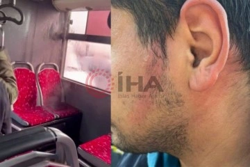 Ümraniye’de İETT otobüsünün klima borusu patladı, bir yolcunun yüzü yandı