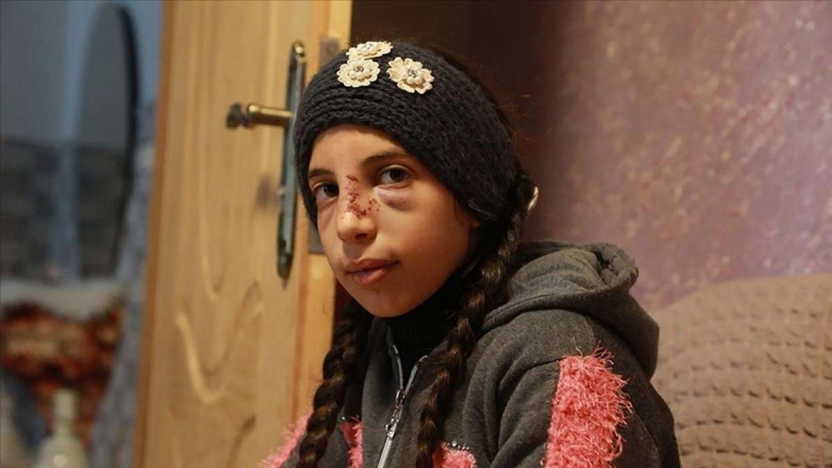 Yahudi yerleşimcilerin saldırısından zor kurtulan Filistinli küçük kız korku içinde yaşıyor