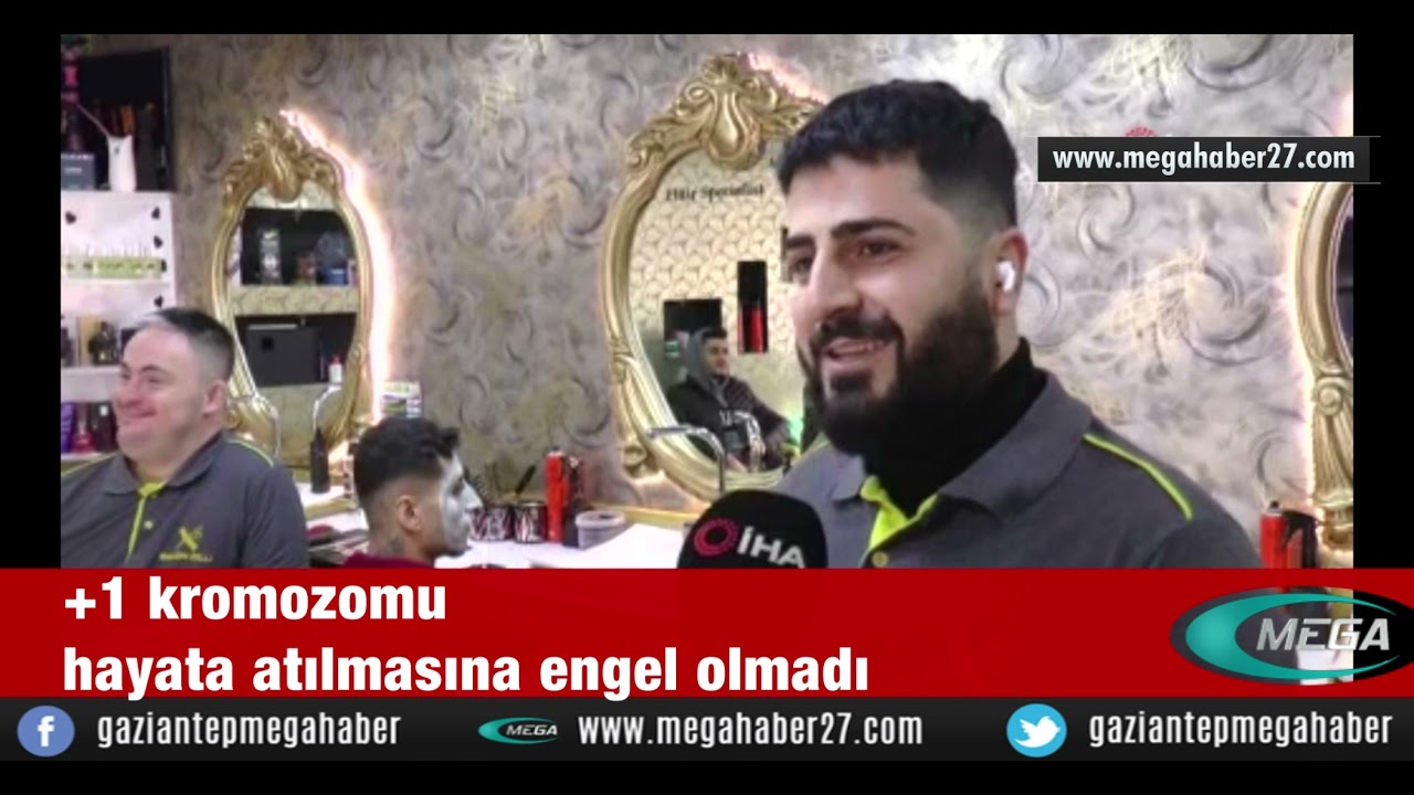 +1 kromozomu hayata atılmasına engel olmadı